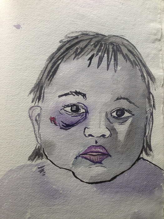 Infant with Purple Eye watercolor on paper